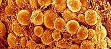 sem-fat-cells225