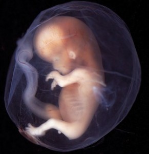 fetus-291x300