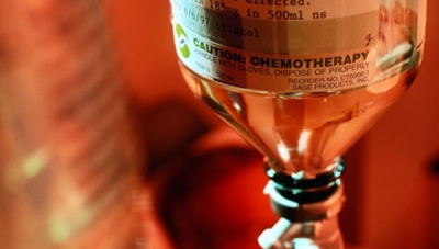 xhmeiotherapeia-chemotherapy