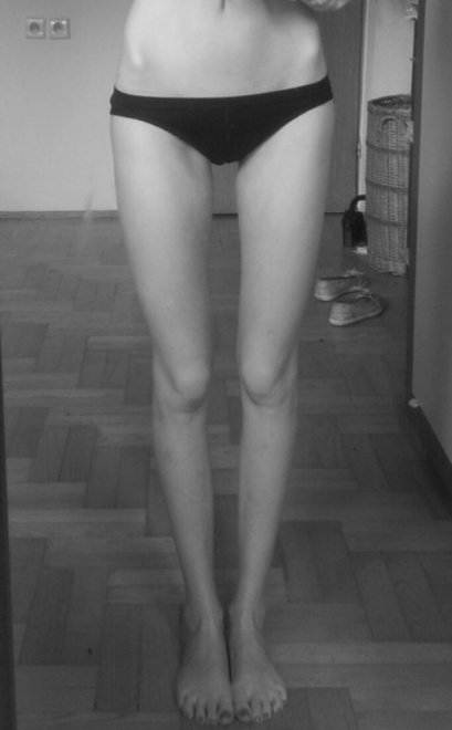 Thigh-Gap2.